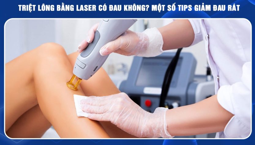 Triệt lông bằng công nghệ Diode laser ruby AI có đau không?