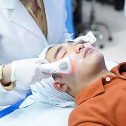 Cách trị mụn ở nam giới hiệu quả - chuẩn y khoa